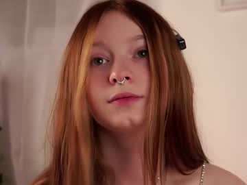 scarlet fever10